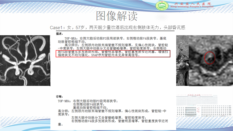 1897fbee74a123a226c4d74a364c229e.png