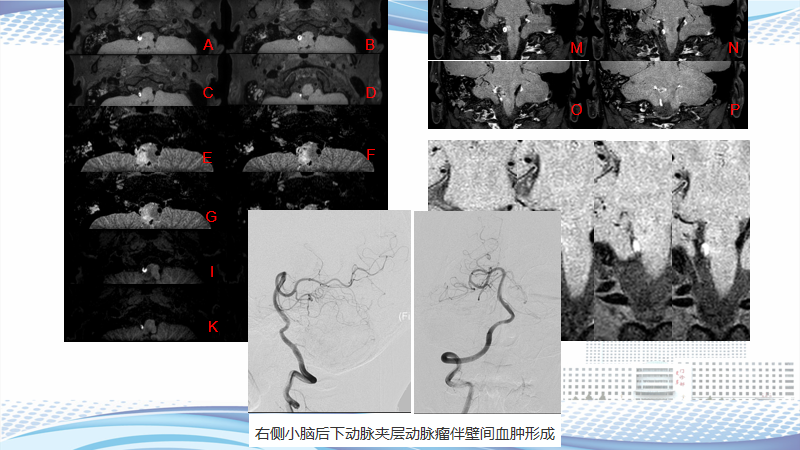 0792a44a19c10a29527607621f6eb869.png