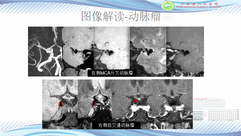 d77b18fdb8e7dc1ac7a887285fddeb81.png