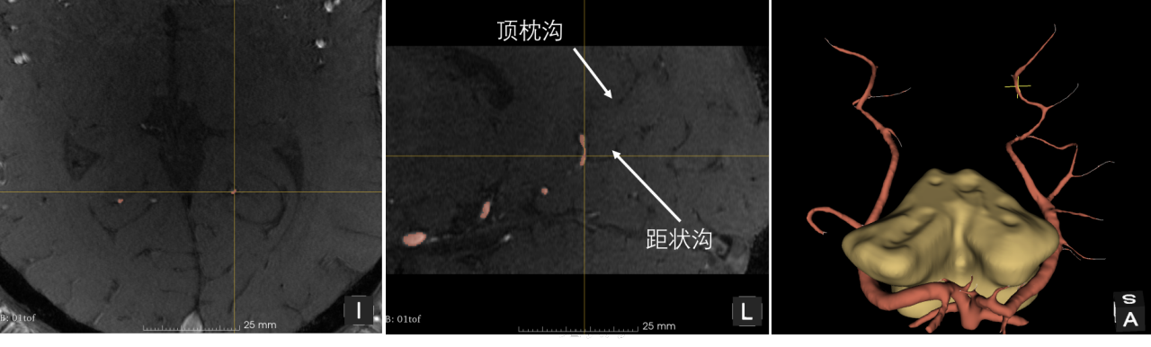 9bb666500cf29f4c81c60debc66535a4.png