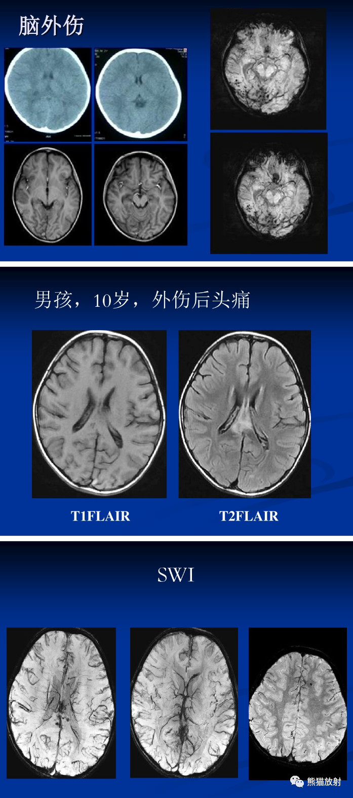 b3924d5346bb2846e2b35b9ce73c79ec.jpg