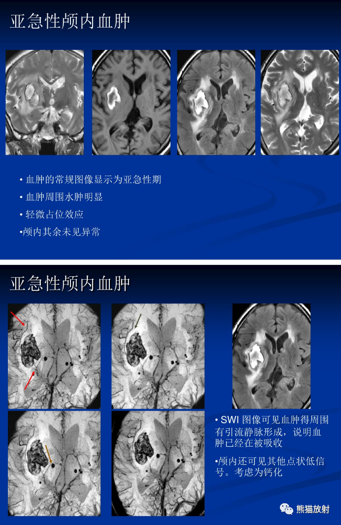 f8674bdb801ae8d5298ae86a02703957.jpg