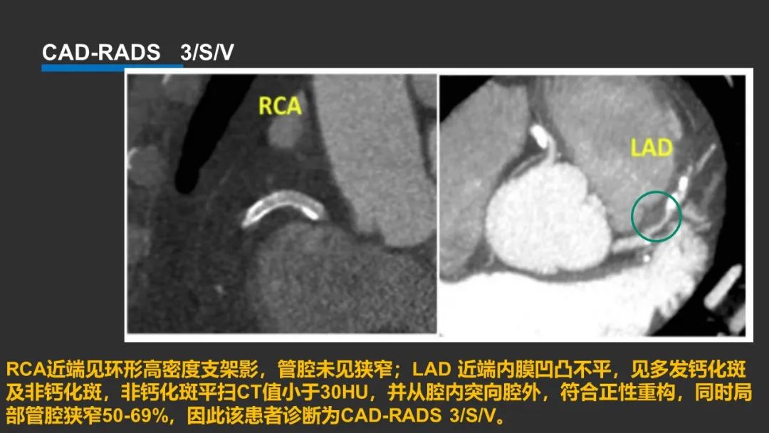 qw37.jpg