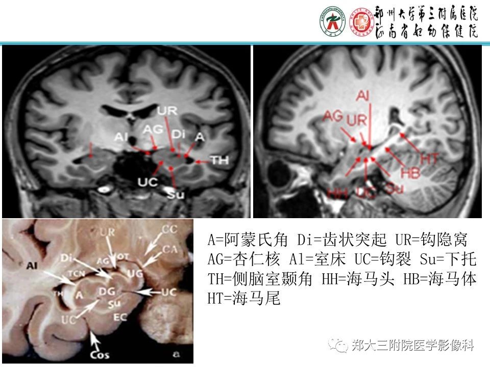 aba06e220ab3371cb6b1a2219dd0fc5c.jpg