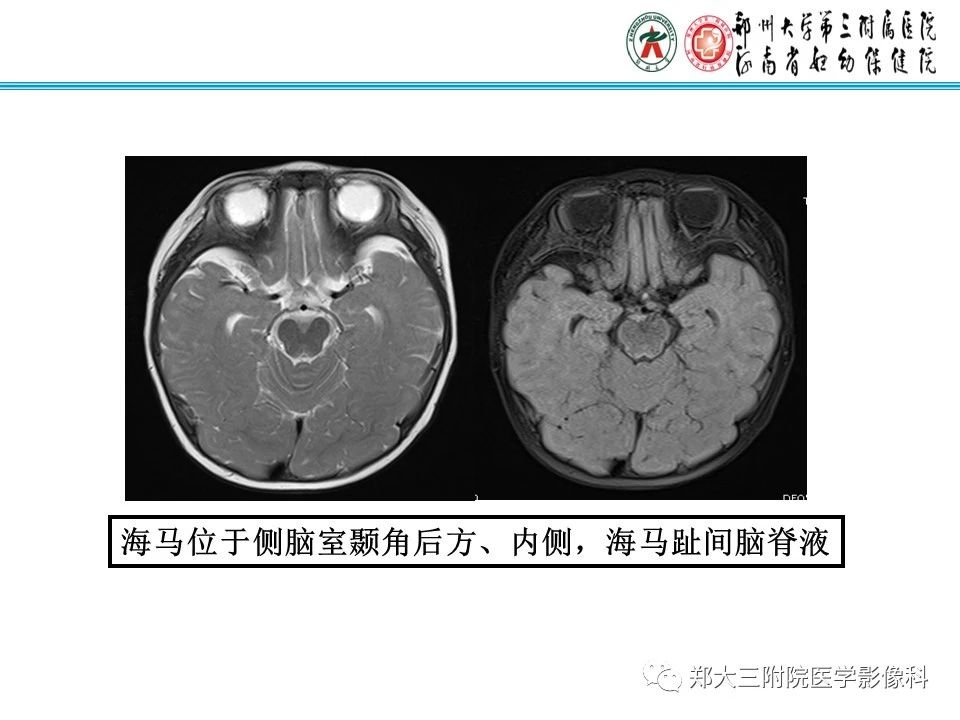 c2eba410af888f3baab9e01c4127c61d.jpg