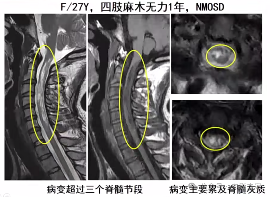 c961cb2e43ea33804c4d02de7016c573.png