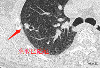 a7e98dc190eda4f237165b2172b88d56.png