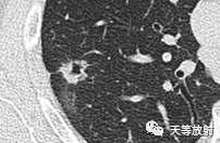 dbbb076a123103511c96e5a7e580a6d7.png