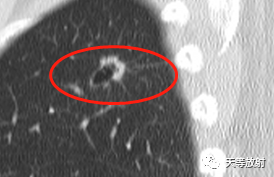 f24b0172b707ca2c7e980c43cb316570.png